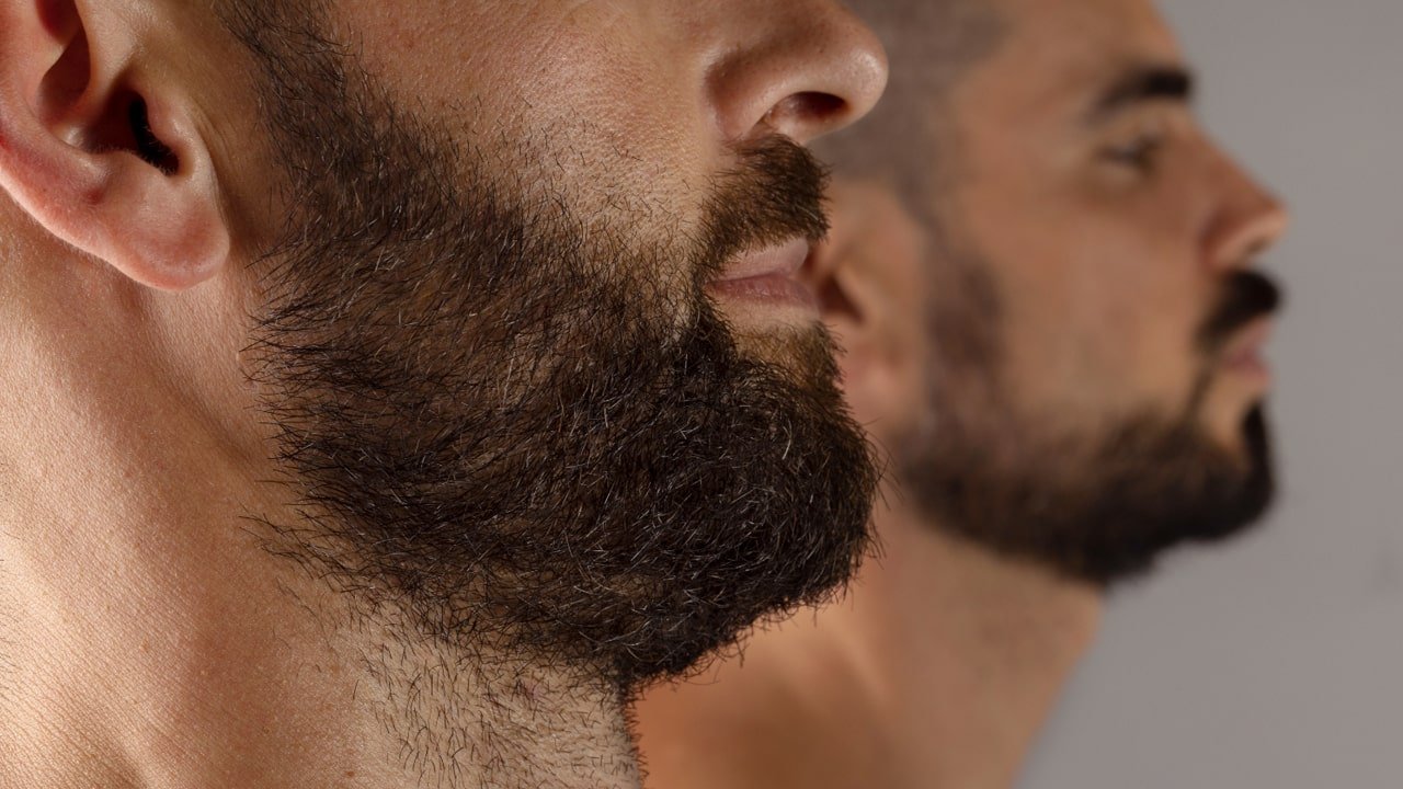 Aplicação de minoxidil para crescimento da barba e recomendações Cara de Macho