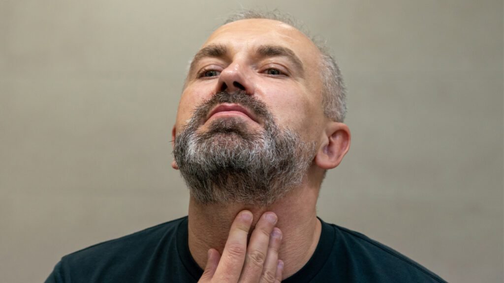 queda de barba em homem