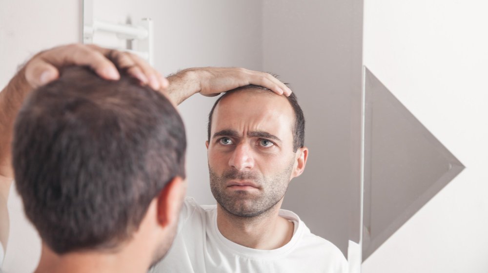 queda de cabelo em homens