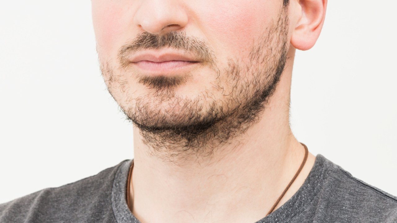 5 motivos que fazem seus fios caírem