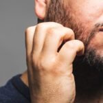 Barba com Caspa e Coceira dicas para evitar