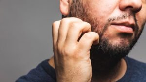Barba com Caspa e Coceira dicas para evitar