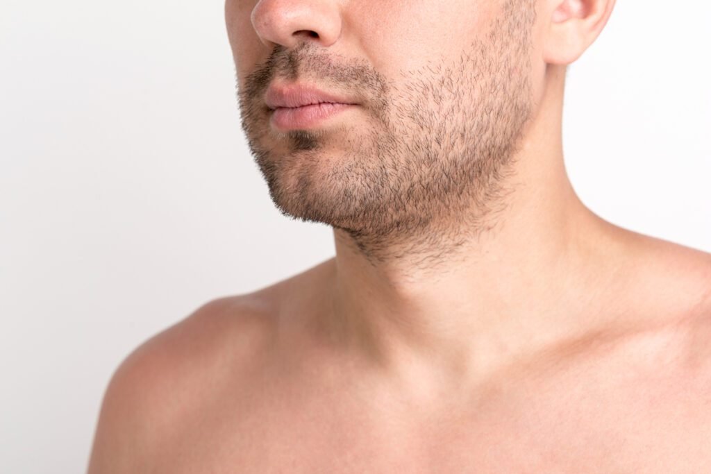 Minoxidil para barba funciona