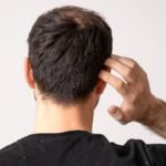 Shampoo Anticaspa Masculino: Ingredientes que Funcionam