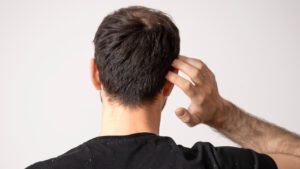 Shampoo Anticaspa Masculino: Ingredientes que Funcionam