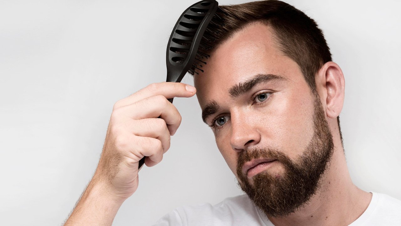 Cabelo Oleoso Masculino: Causas e Rotina Diária