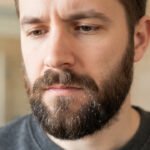Caspa na Barba: Diferença para Dermatite e Como Higienizar