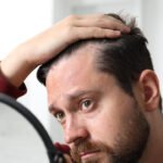 Entradas no Cabelo: Corte Certo e Tratamento Antes da Calvície