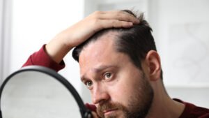 Entradas no Cabelo: Corte Certo e Tratamento Antes da Calvície
